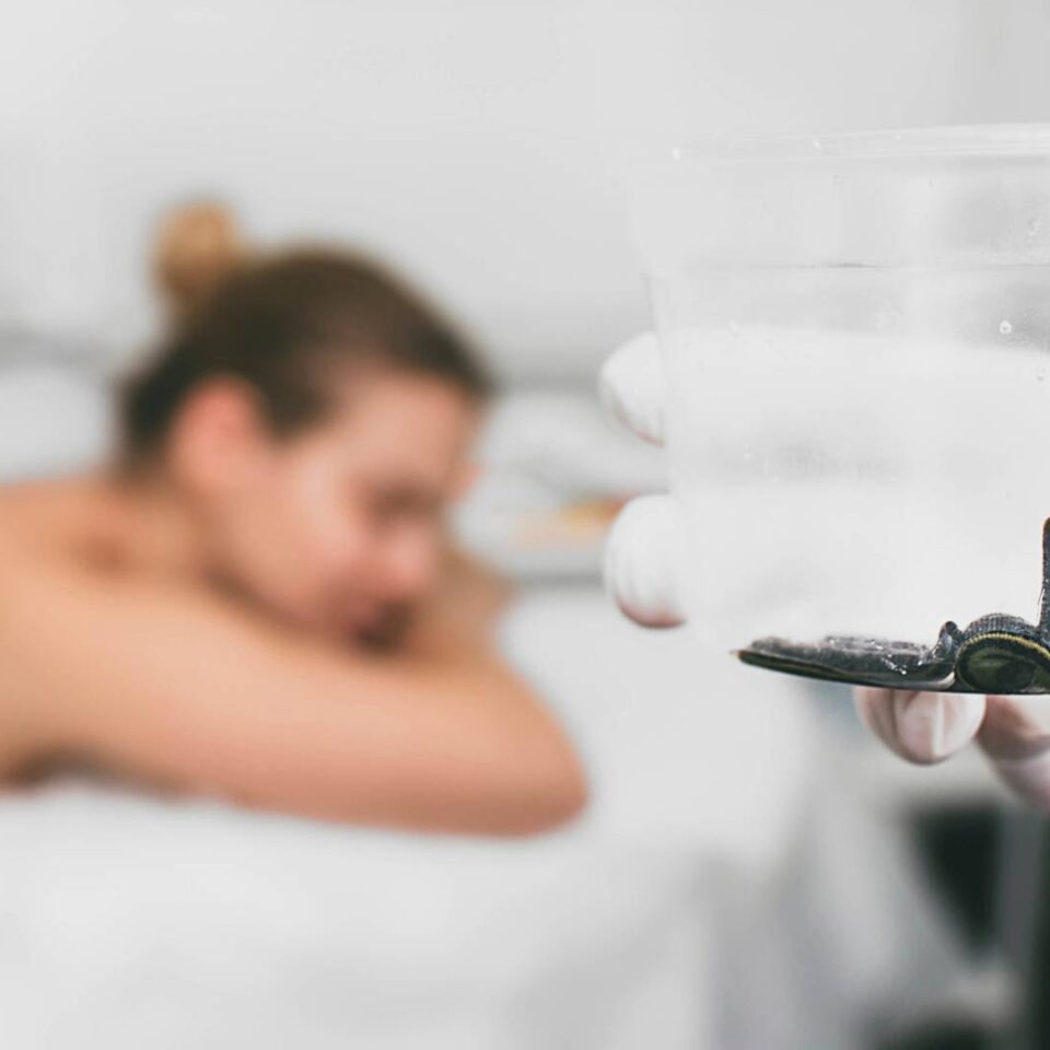 zabieg hirudoterapii w Szczecinie, pijawki lekarskie w słoniku na tle pacjenta przygotowanego do zabiegu